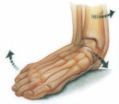 pronation/flat feet