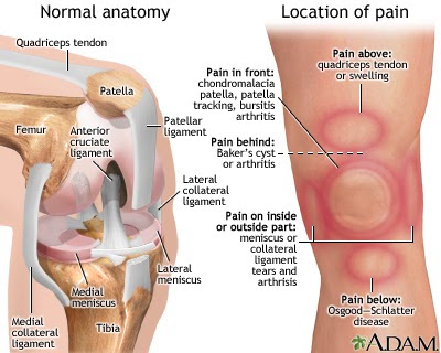 location of pain